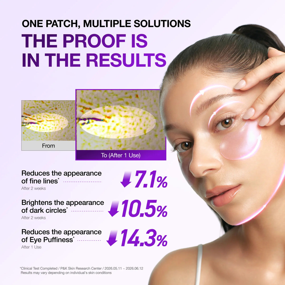 ANUA Retinol Berry Eye Patches, 60 Count